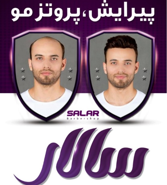 پروتز مو سالار در ارومیه پروتز مو سالار در ارومیه